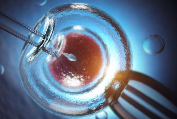 IVF Treatment in Laxmi Nagar