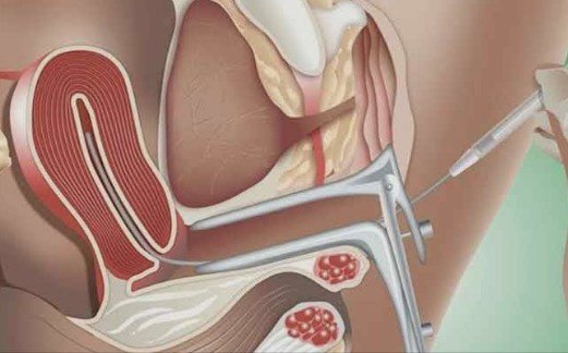 IUI Specialist in Laxmi Nagar