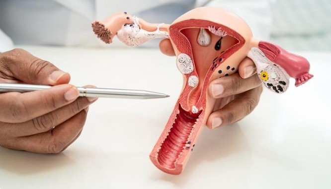 Best Adenomyosis Treatment in Laxmi Nagar